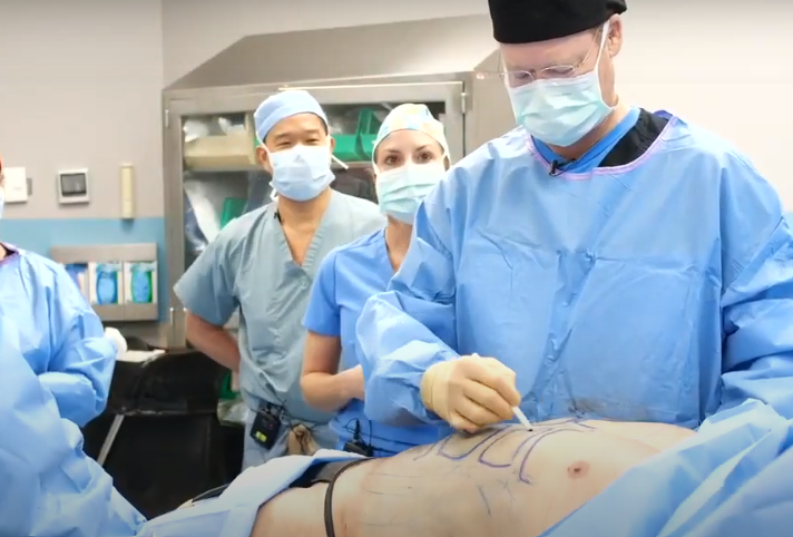 BodyTite and Morpheus8 body by Dr Henry Mentz