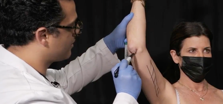 Dr Dayan with FaceTite, BodyTite and Morpheus8 Body Burst