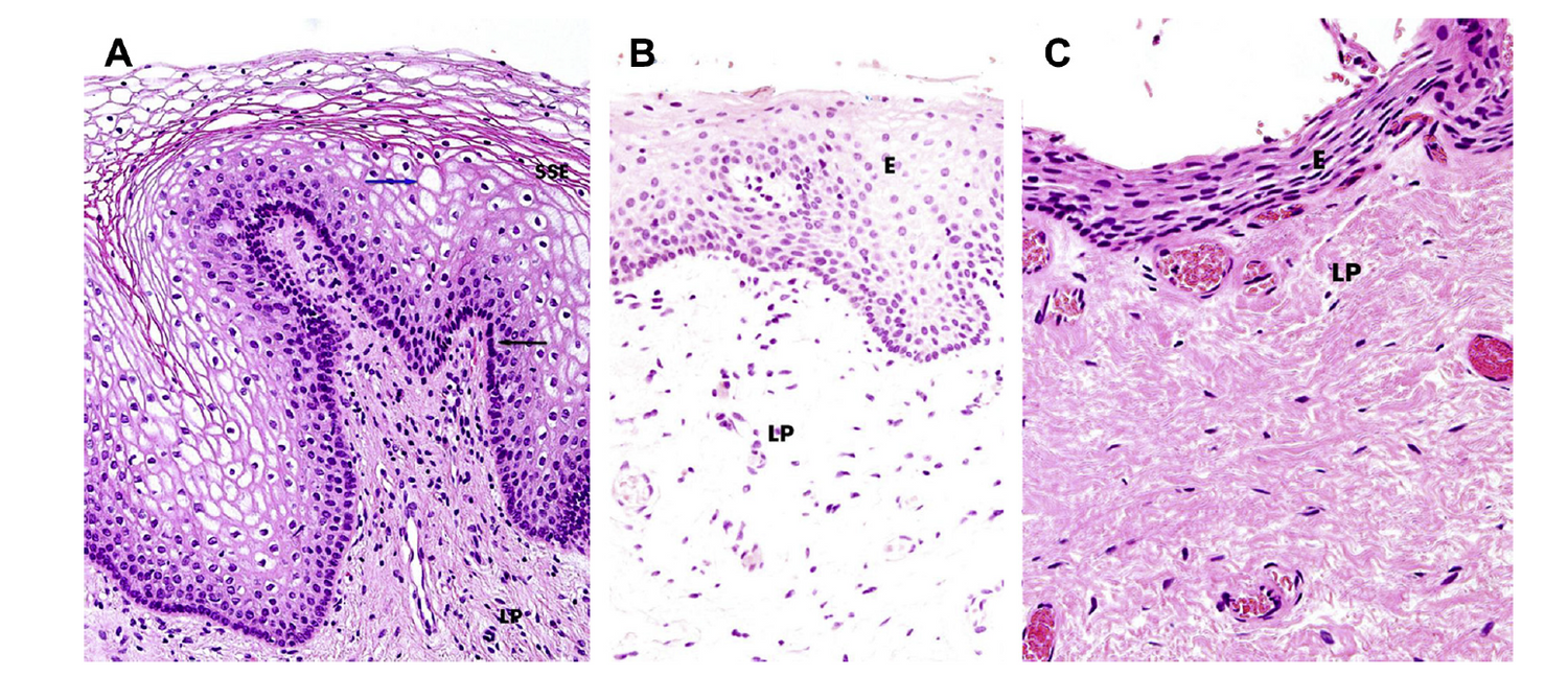 Nonsurgical Vaginal Rejuvenation