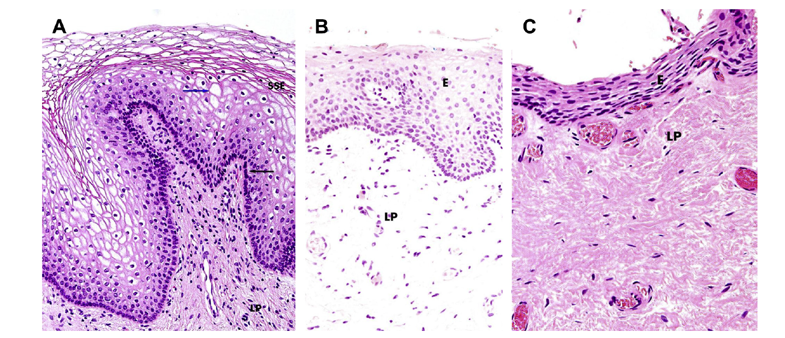 Nonsurgical Vaginal Rejuvenation