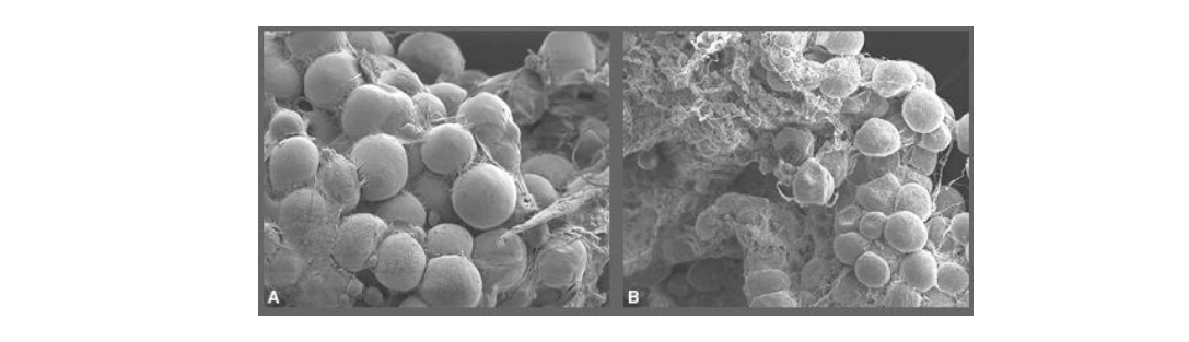 Late to the Party? Pyroptosis Becomes a New Mechanism of Cell Death for Adipocytes