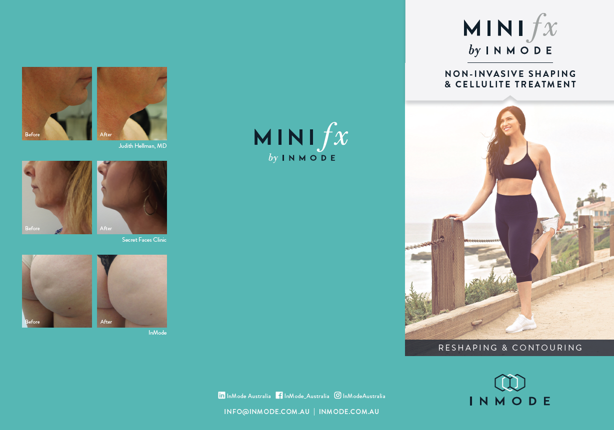 MiniFX Patient Brochure (English) x 125
