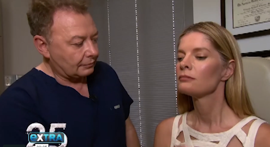 EXTRATV – DR NIKOLOV PERFORMS THE EMBRACERF PROCEDURE ON MICHELLE STAFFORD
