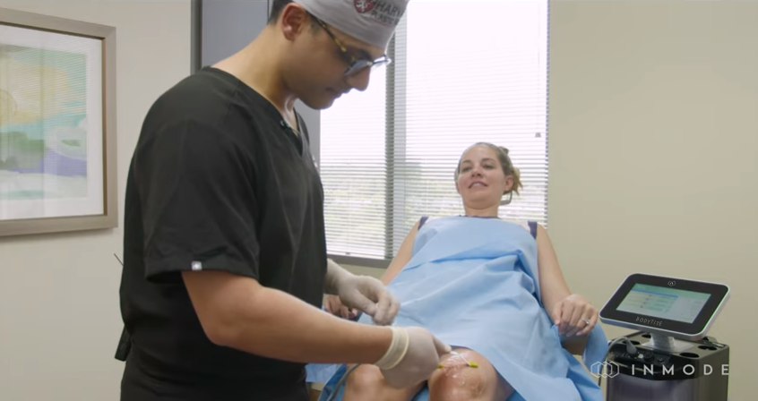 Live Demo: Non Surgical Knee Skin Tightening with AccuTite RF – Dr. Erez Dayan