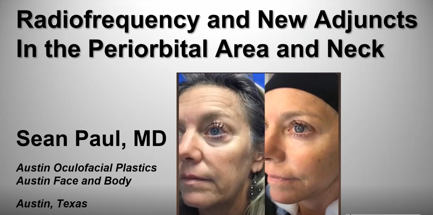 Webinar: Lower Eyelid Rejuvenation with AccuTite & Morpheus8 – Dr. Sean Paul