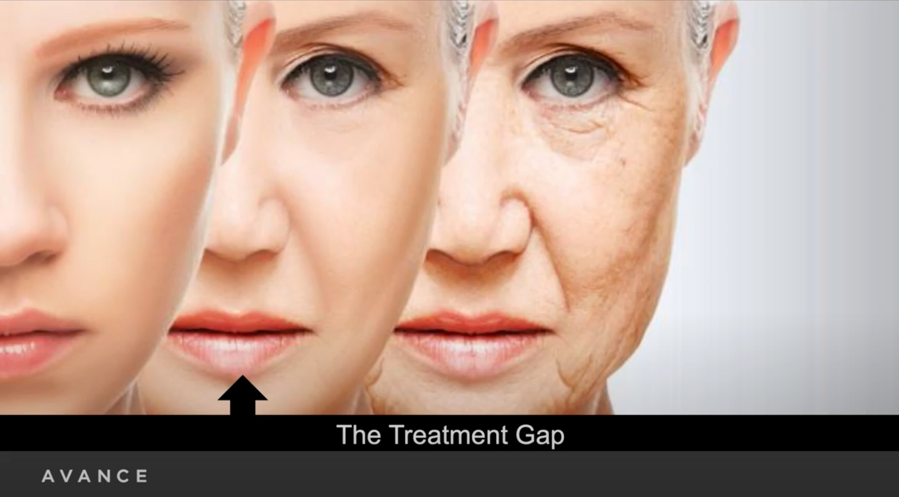 Evolve, The Treatment Gap with Dr Erez Dayan