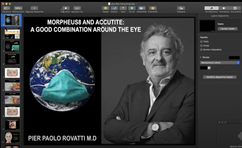 Morpheus8 and AccuTite: A Good Combination Around the Eye with Dr Rovatti