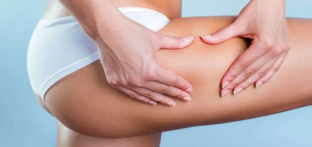 THE LATEST INNOVATIONS IN CELLULITE TREATMENTS