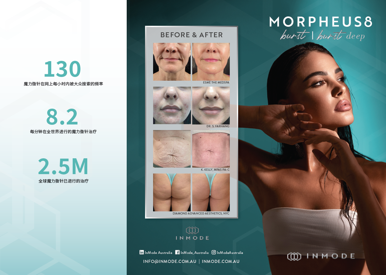 Morpheus8 Burst & Burst Deep Patient Brochure (Chinese) x125