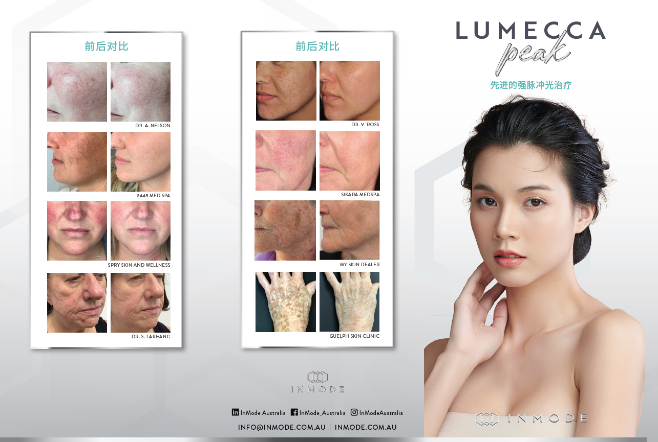 Lumecca Peak Patient Brochure (Chinese) x125